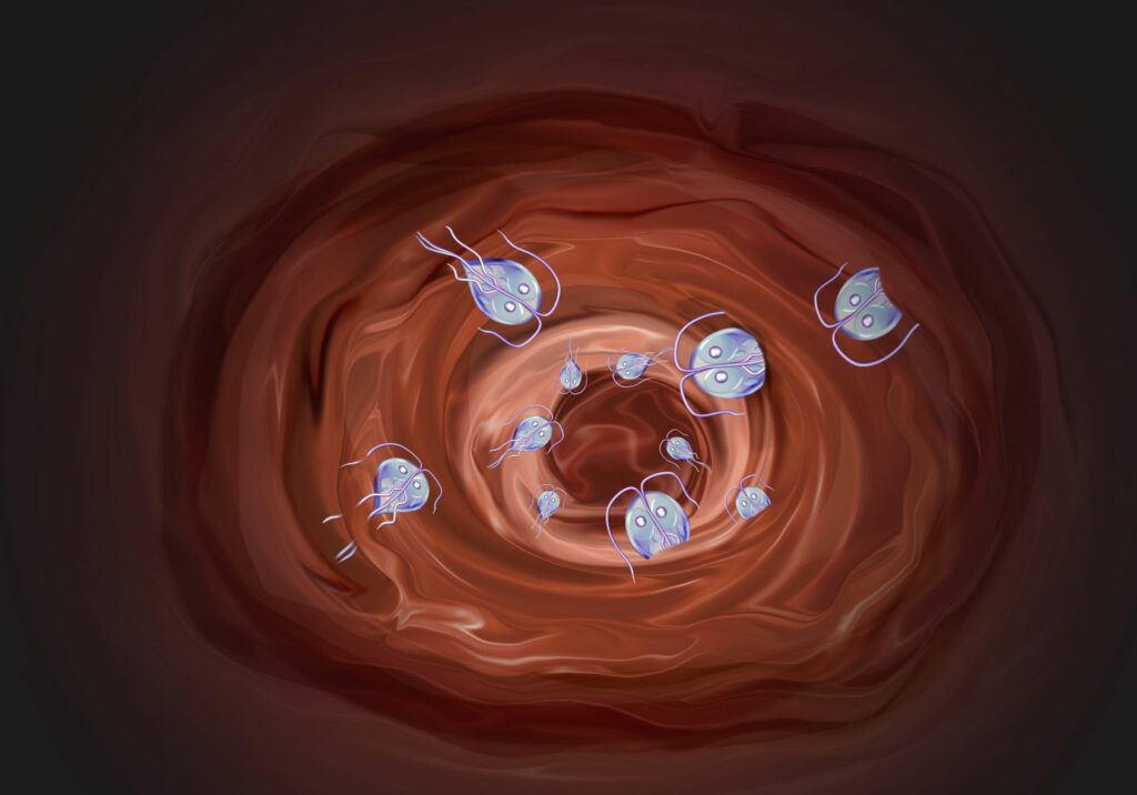 giardia en perros que es a shuvalov trichinosis