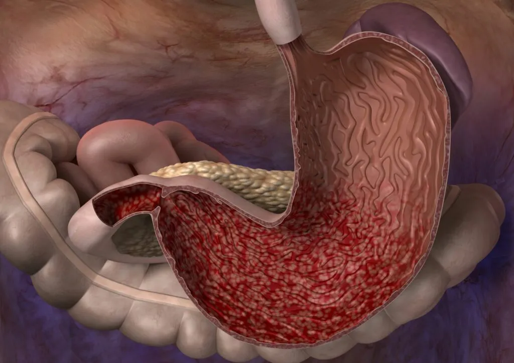 gastritis en perros