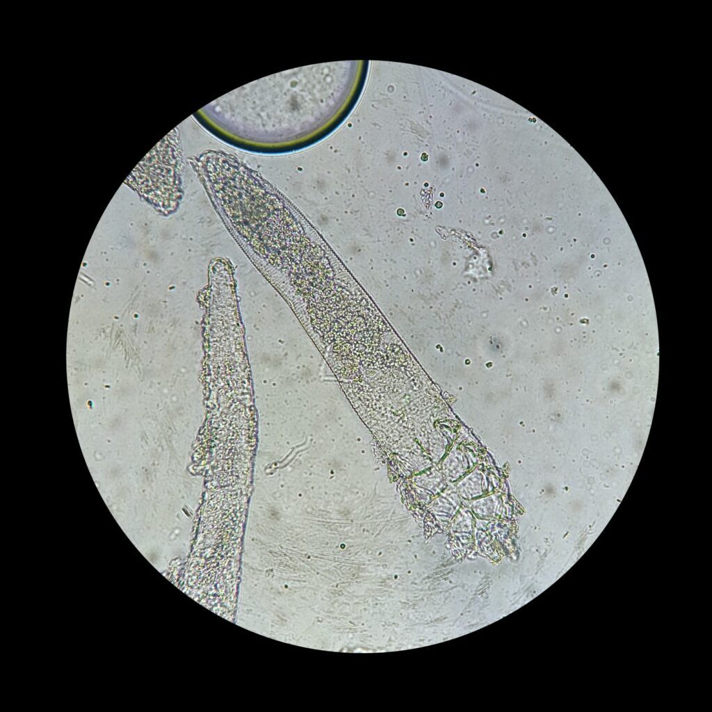 Demodex canis