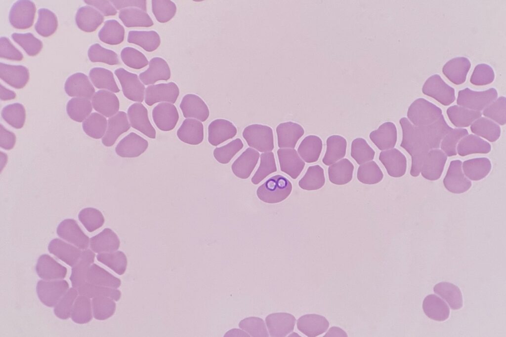 Babesiosis en perros